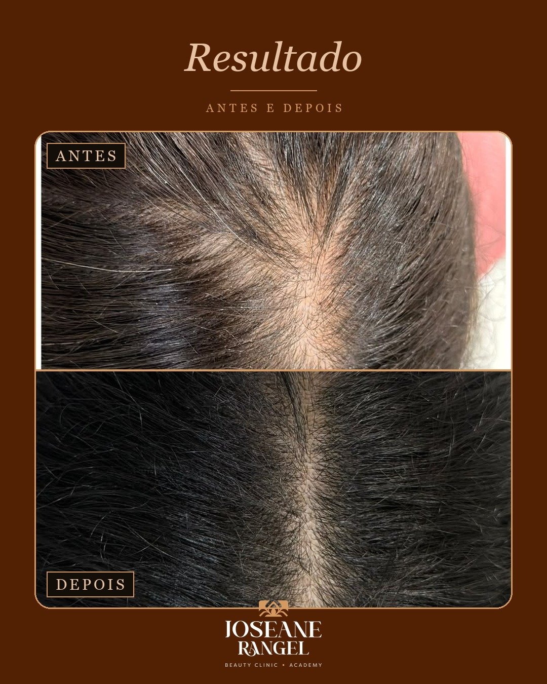 Evolução capilar, antes e depois