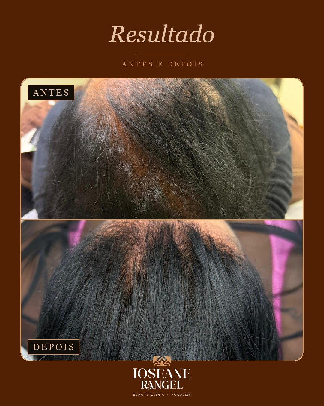 Evolução capilar, antes e depois