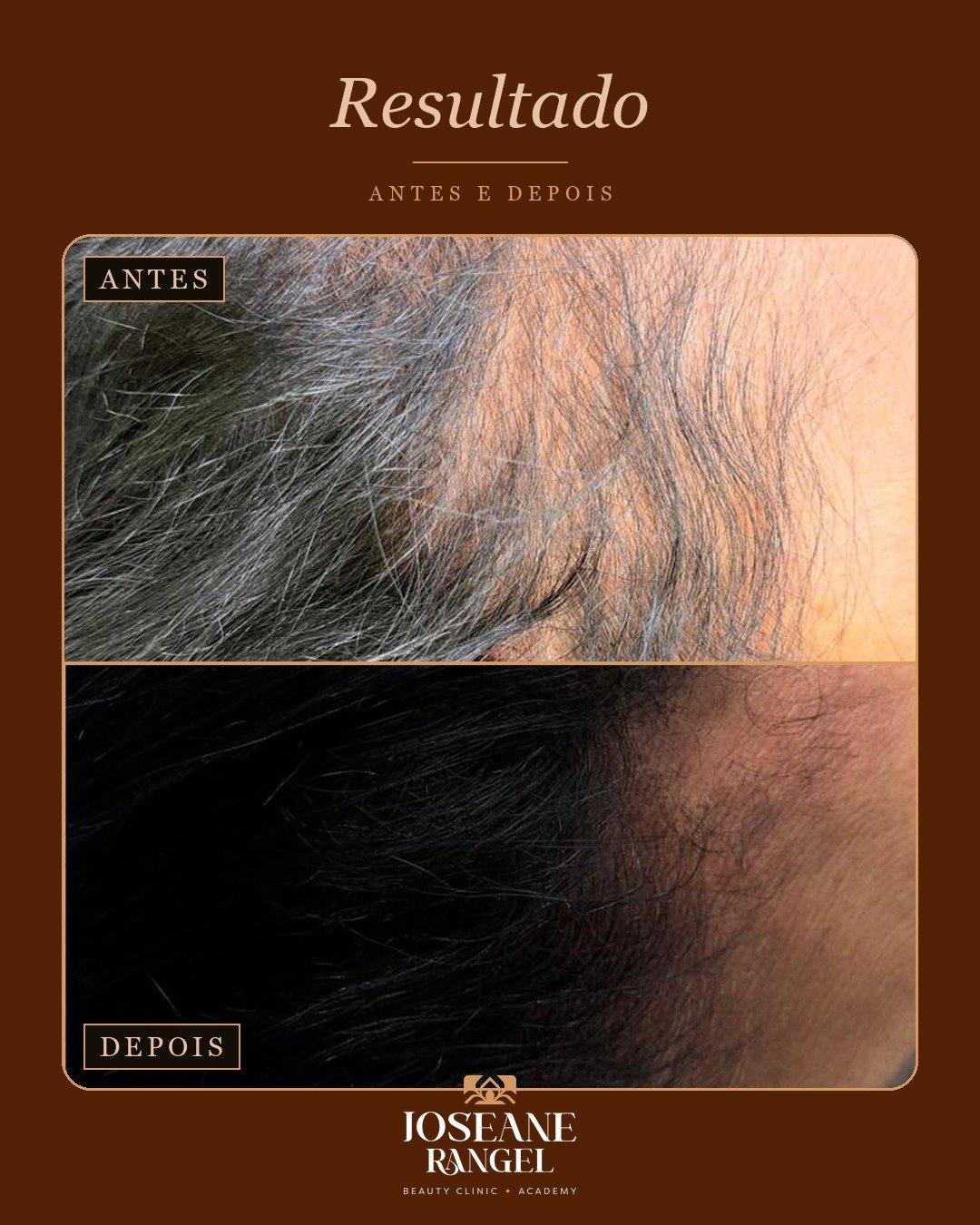 Evolução capilar, antes e depois