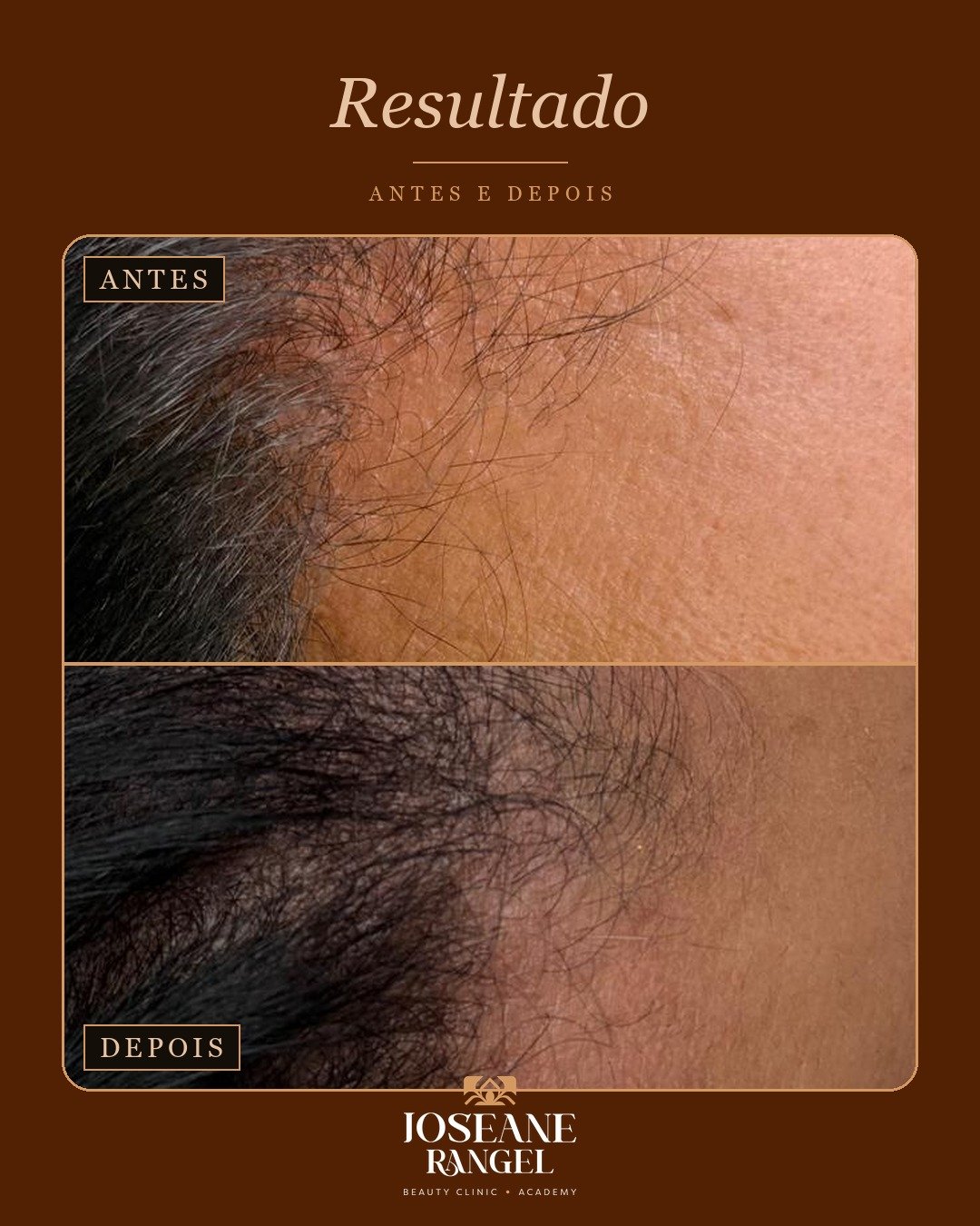 Evolução capilar, antes e depois