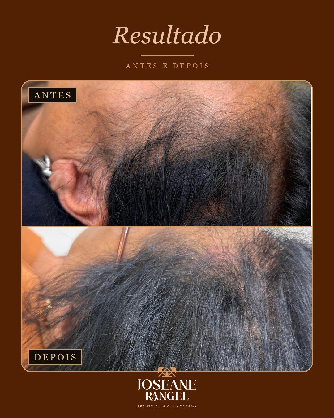 Evolução capilar, antes e depois