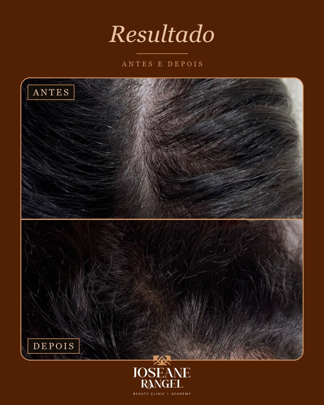 Evolução capilar, antes e depois
