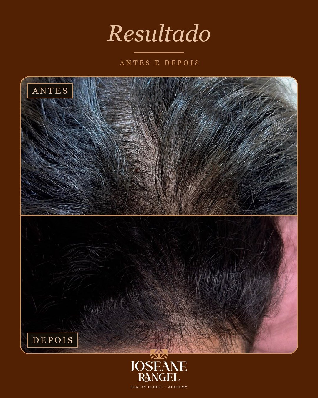 Evolução capilar, antes e depois